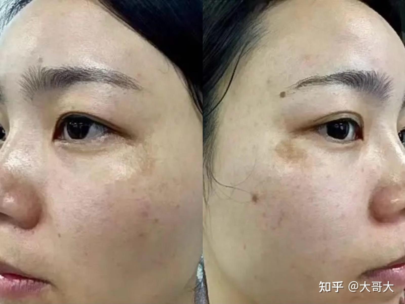 最新捕捉斑現(xiàn)象，多維視角深度解析